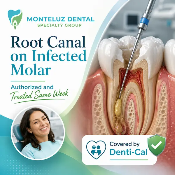 Root canal on infected molar — authorized and treated same week